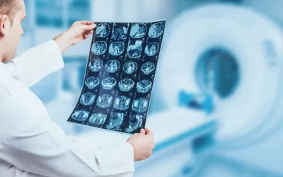 Rezonans magnetyczny w diagnostyce chorób głowy